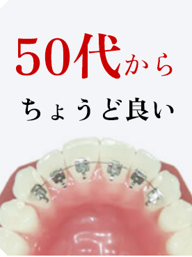 50代から