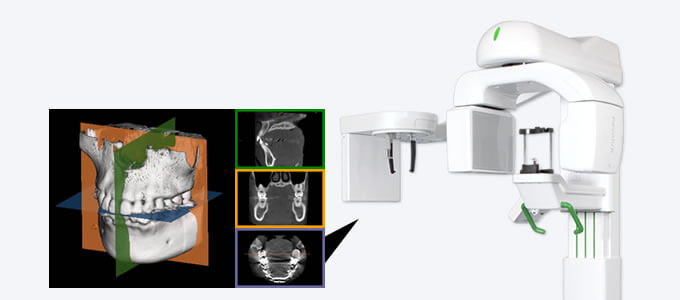 歯科用CTの設置